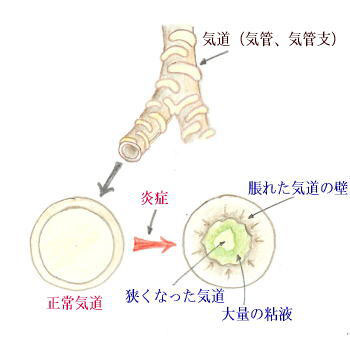 連載童話「たばこ王国」第6回　文・絵:吉田 仁