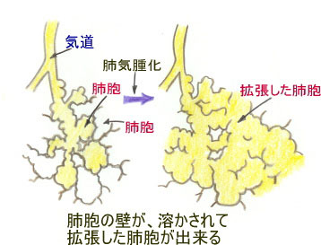 連載童話「たばこ王国」第7回　文・絵:吉田 仁