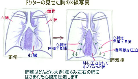 連載童話「たばこ王国」第7回　文・絵:吉田 仁